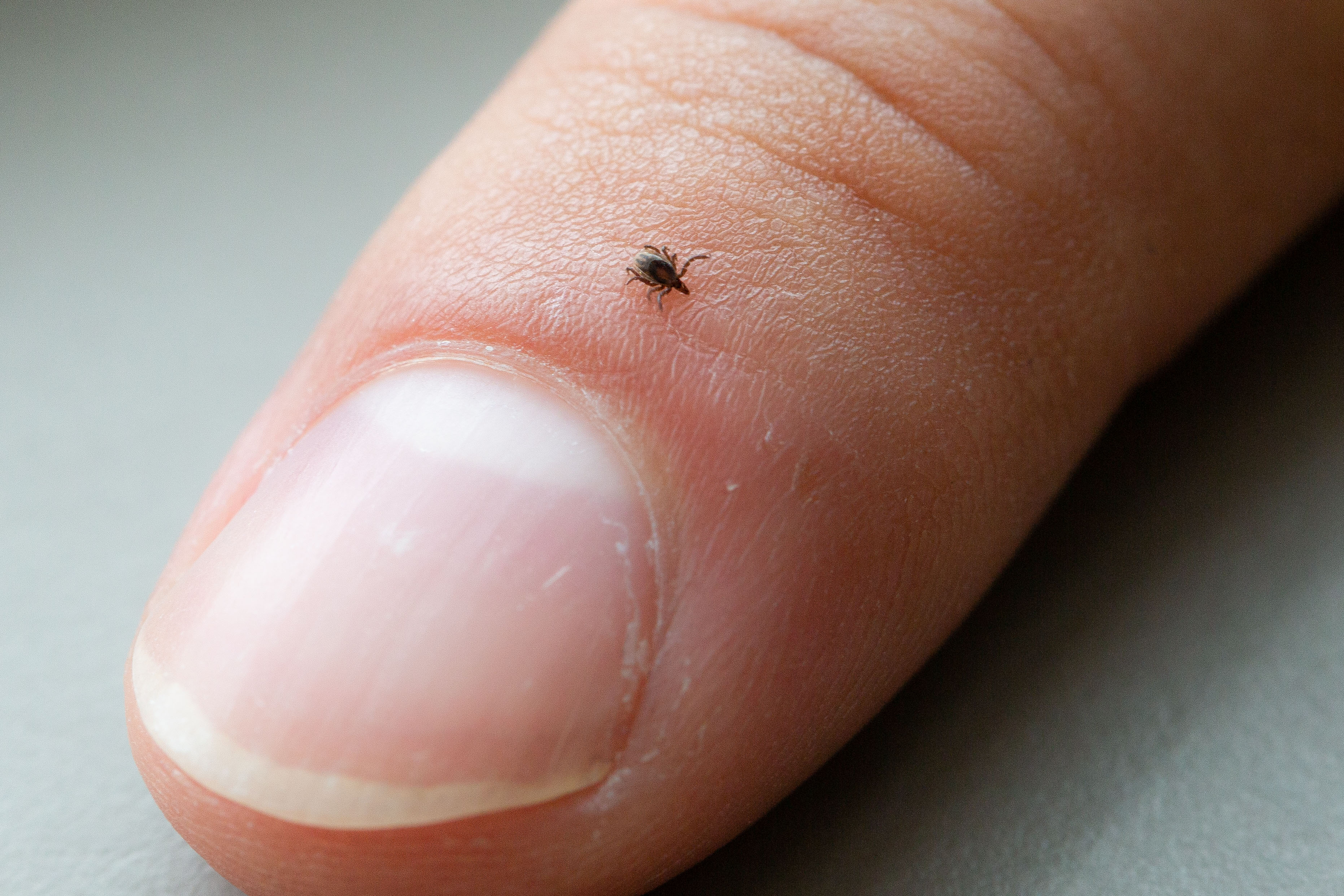 Nymph blacklegged tick on a thumb.